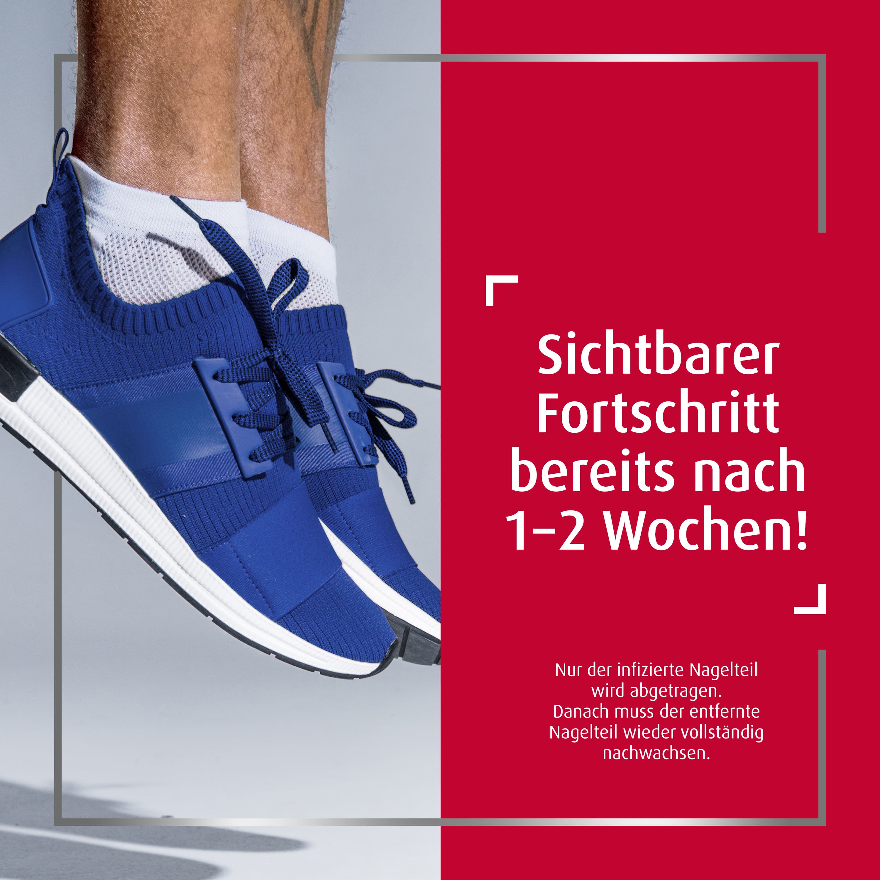 Canesten® EXTRA Nagelset